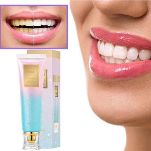Dentifricio Sbiancante Niacinamide - Dì addio ai problemi orali - 100g - Foto 7 di 12