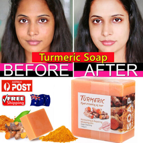 Lymphatic Detox Tumeric Soap Dark Spots Skin Glow Body Brighter Whitening Soap - Picture 1 of 23