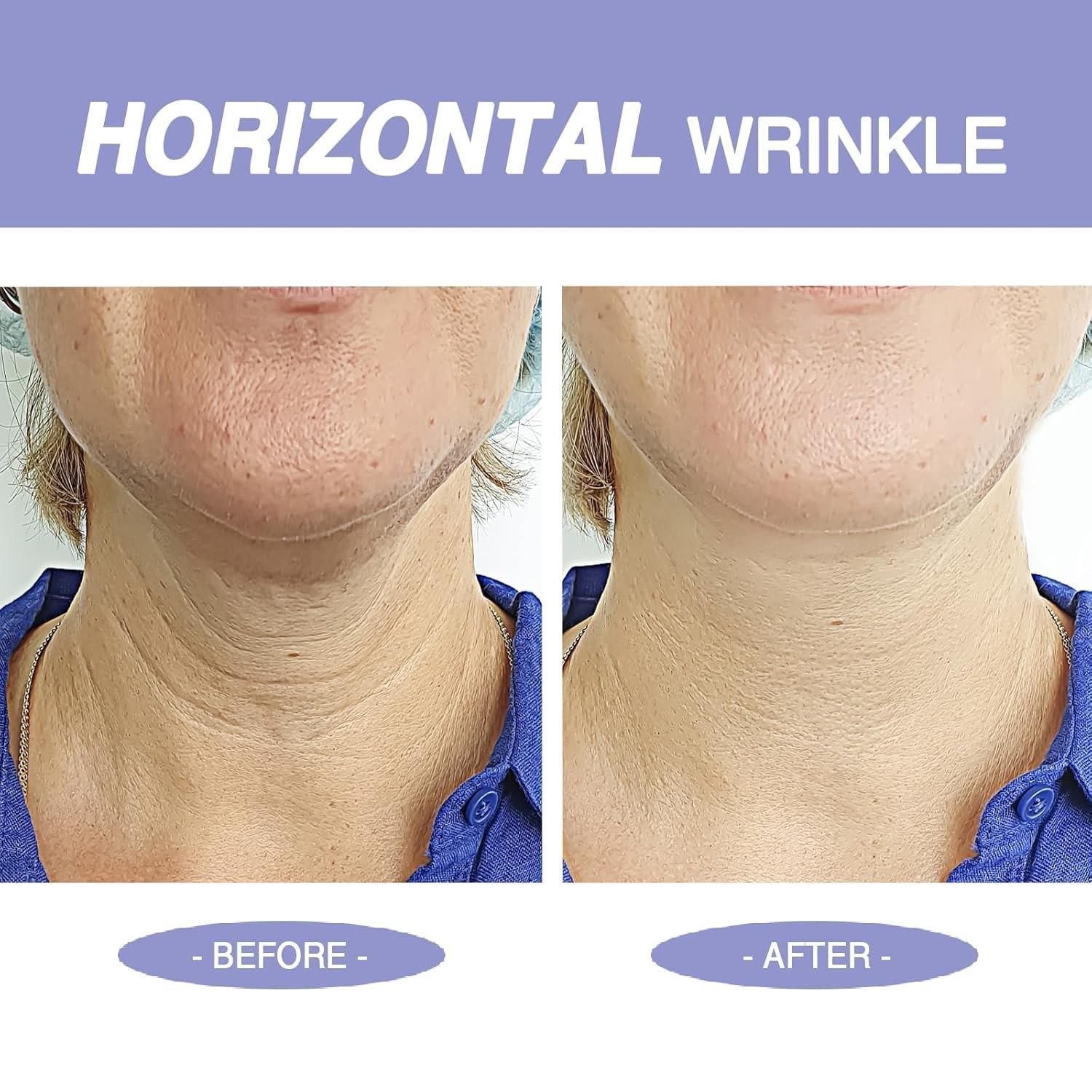 Neck Cream, Neck Creams for Tightening and Firming, Anti Aging Tighten & Lift Fa