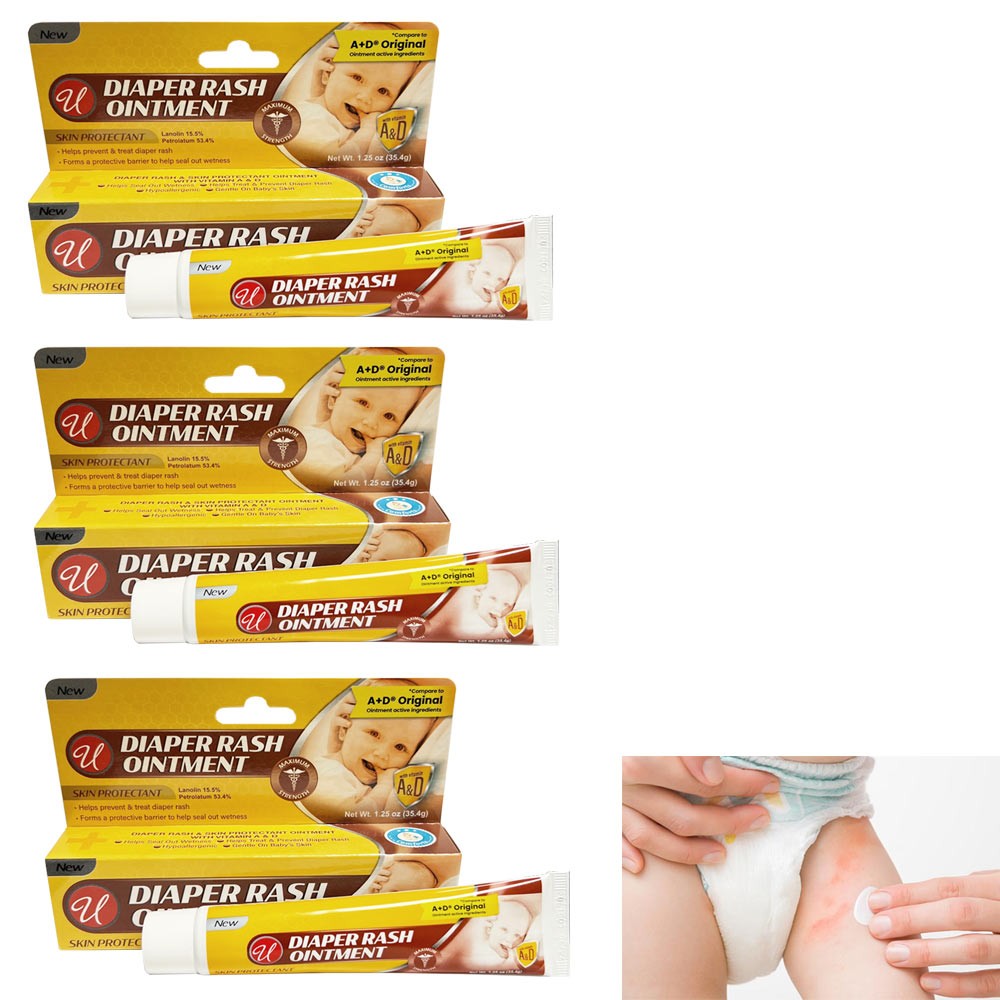 Rash Treatment Ointment Baby Healing Dry Skin Protectant