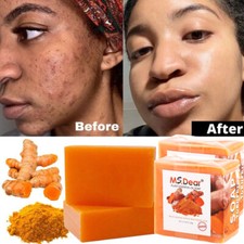 1-3X Turmeric Soap Skin Whitening Dark Spots Lightening Acne Brightening Tumeric