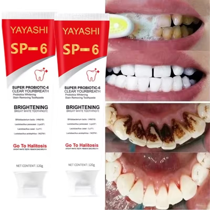 2Pcs Super Probiotic SP-6 Toothpaste, Probiotics Bright White Toothpaste, Sp 6