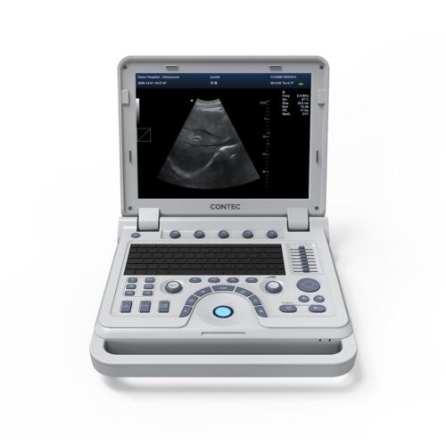CONTEC CMS600P2PLUS Laptop Ultrasound Machine 15TFT Display optional - Picture 1 of 15