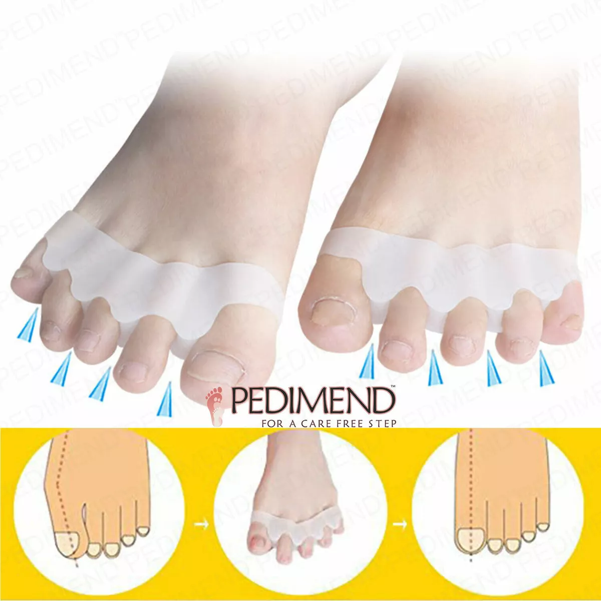 PEDIMEND Toe Separators - Gel Toe Spacers to Correct Bunions, Hammer Toes -  UK