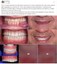 The Ultimate Guide to 3D Printer for Dental