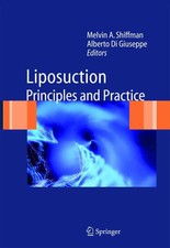 Alberto Di Giuseppe (u. a.) | Liposuction | T...