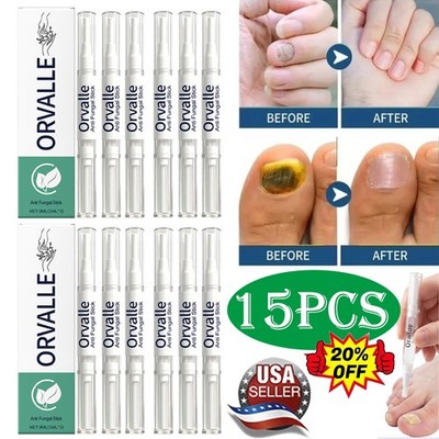 3-15X Orville Nail Fungus Pen Anti Fungus Infection Nail Care Repair Pen Toenail