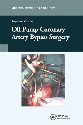 Raymond Cartier | Off-Pump Coronary Artery Bypass Surgery | Taschenbuch (2019)