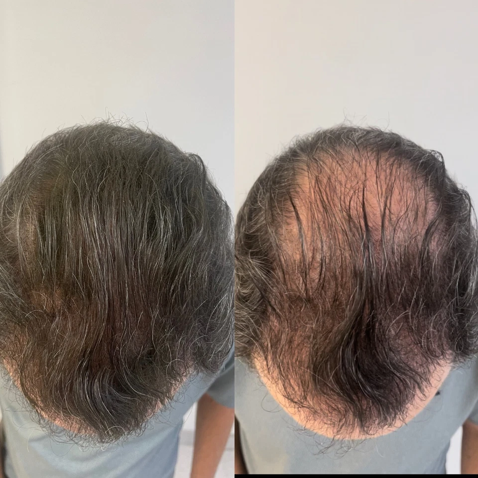 Hair Building Fibers Refill Light Brown 500g Thinning Hair Concealer TOP QUALITY - Image 2 of 2