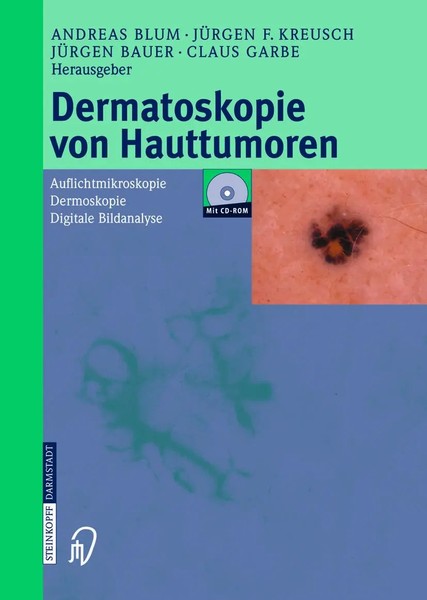 Dermatoskopie Von Hauttumoren A. Blum (U. A.) Taschenbuch Xvi Deutsch 2012-image