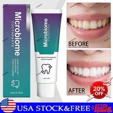 Microbiome Mint Flavor Gum Toothpaste Cleaning Toothpaste Sensitive Teeth 120g
