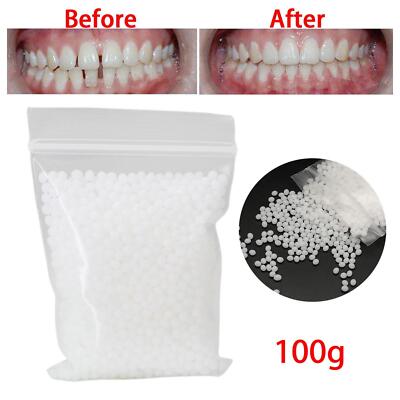 100G Provisorisches Zahnreparaturset Formbarer Zahnersatz Provisorischer Zahnfix Falseteeth
