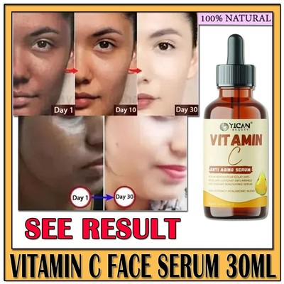 Vitamin C Face Serum - Dark Spot Remover Facial Serum, Vit C Serum 30ml