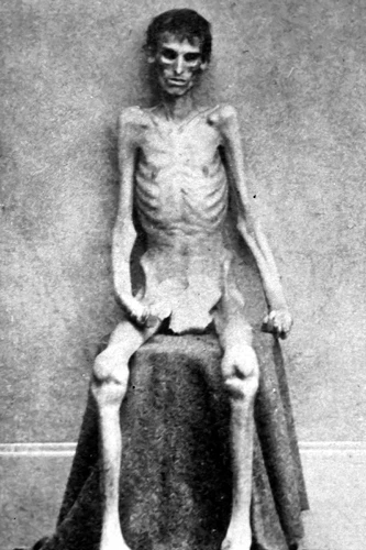 New 5x7 Civil War Photo: Escaped Union - Federal Soldier Prisoner of War