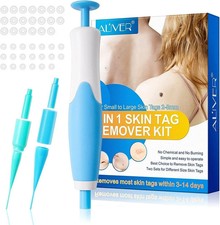 40x Rubber Bands 2in1 Painless Auto Skin Tag Mole Wart Removal 10x Alcohol Pad