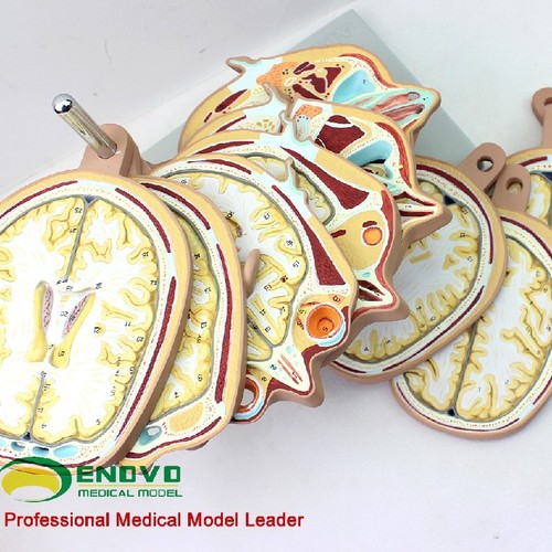 19*17.5*24.5cm Horizontal Section 12pcs Human Head CTMRI Anatomy Brain Model - Picture 13 of 14