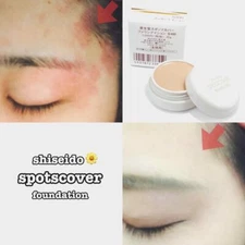 Shiseido Spots Cover foundation For large bruises, spots, burn marks, and wounds