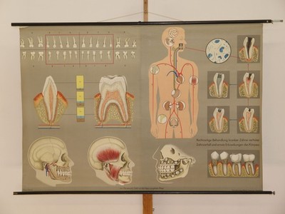 Dentures Teeth Dentist Oral Surgeon Teaching Chart ~1965 Wall Picture 164x114cm