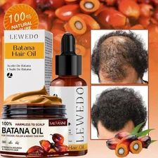 Natural Batana Oil Serum For Hair Growth Healthier Thicker Fuller Anti Hair Loss