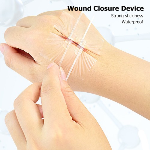 2pcs Emergency Wound Closure Device Zip Laceration Repair Adhesive Bandage W GFL - Picture 1 of 23