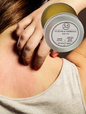 Eczema  Psoriasis Relief Salve