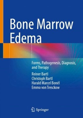 Bone Marrow Edema by Reiner Bartl HARDBACK 9783662723203