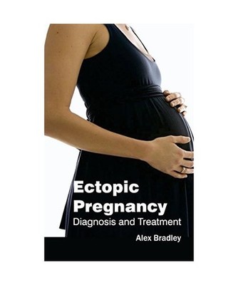 Ectopic Pregnancy: Diagnosis and Treatment: Diagnosis and Treatment