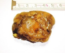 Großer, baltischer Roh-Bernstein, teilweise Butterscotch    18,0 g.