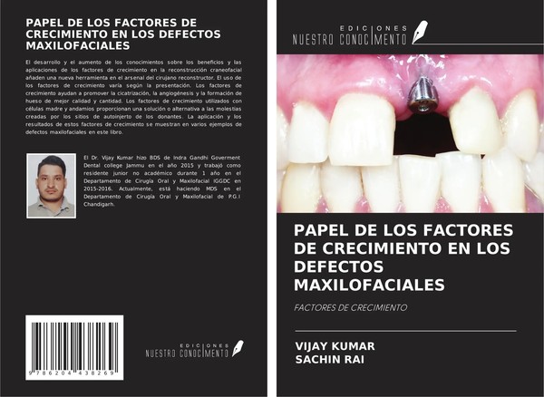 Vijay Kumar (U. A.) | Papel DE LOS Factores DE Crecimiento EN LOS Defectos...-image