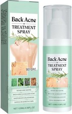 Back Acne Body Spray Treatment 120ml Clear Spots Blemishes Blackheads Salicylic