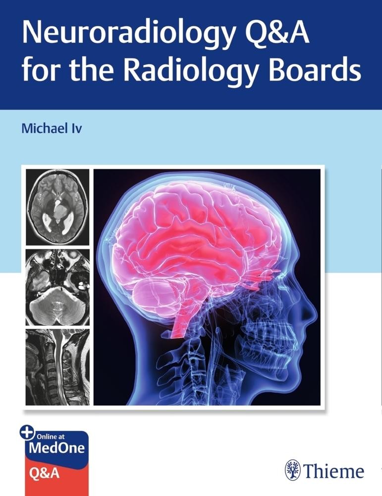 Neuroradiology Q&A for the Radiology Boards Michael Iv