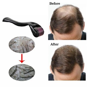 Hair Regrowth Micro Needling Roller Beard Growth Product Anti Hair