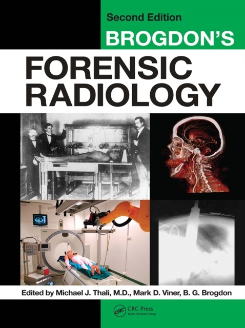 Brogdons Forensic Radiology by M.D. Thali PAPERBACK 9781032917931