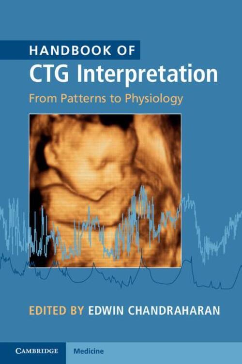 Thumbnail - Edwin Chandraharan | Handbook Of Ctg Interpretation | Taschenbuch |