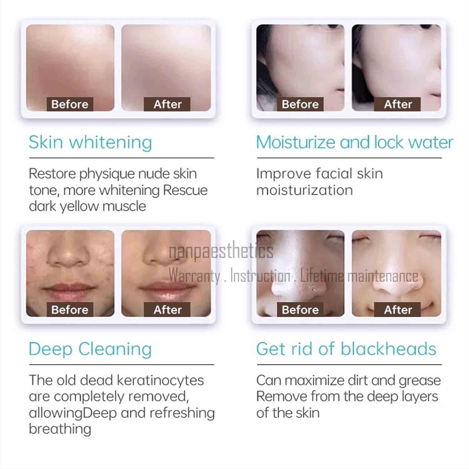 7in1 Water Dermabrasion Hydra Machine Deep Clean Skin Care Facial Spa RF Ge-neo