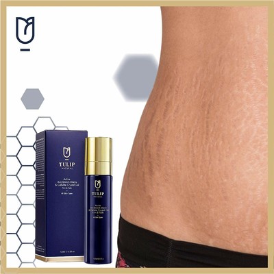 farmasi stretch marks