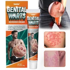 Genital Warts Remover Cream for Skin Tags Body Discomfort Relief USA