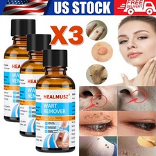 3Pcs Wart Remover Liquid Skin Tag Mole Remover Eliminate Feet Corn Wart Removal