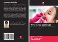 Ortodontia Acelerada Mohamed Shafi N (U. A.) Taschenbuch Portugiesisch 2025