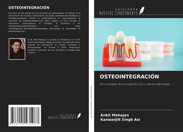 Ankit Mahajan (U. A.) | OsteointegraciÓN | Taschenbuch | Spanisch (2022)-image