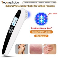 308nm Uvb Light Therapy At Home Handheld for Face Skin Diseases 45mW/cm 