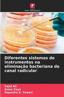 Diferentes Sistemas De Instrumentos Na EliminaçãO Bacteriana Do Canal Radicular