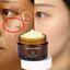 thumbnail 1  - whitening cream Retinol removes melasma acne spots pigment dark spots pigment 