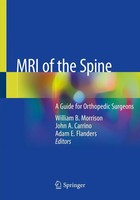 William B. Morrison (U. A.) | MRI Of The Spine | Taschenbuch | Englisch (2021)