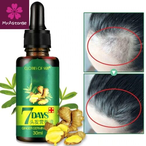 5x Hair Regrow 7 Day Ginger Germinal Serum Essence Oil Loss Treatement Growth - Afbeelding 1 van 7