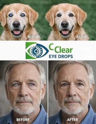 N-Acetyl-Carnosine Eye Drops 2% Natural Eye Care Solution 10ml x2