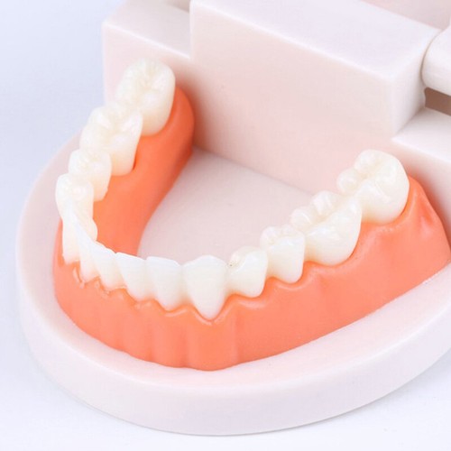 Standard Teeth Model Adult Standard Typodont Demonstration Denture Model Display - Picture 4 of 10