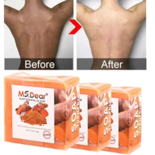 3/2Pcs Ginger Tumeric Soap Anti-Acne Dark Spots Removal Body Whitening Soap Bar