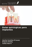 GuíAs QuirúRgicas Para Implantes Ancita Caroline D'souza (U. A.) Taschenbuch