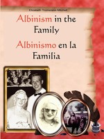 Elizabeth Tromsness Mitchell | Albinism In The Family | Taschenbuch | Englisch